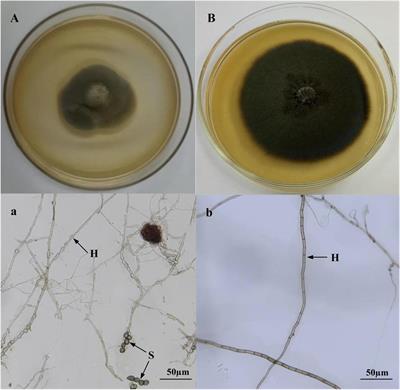 Characterization of Dark Septate Endophytic Fungi and Improve the Performance of Liquorice Under Organic Residue Treatment